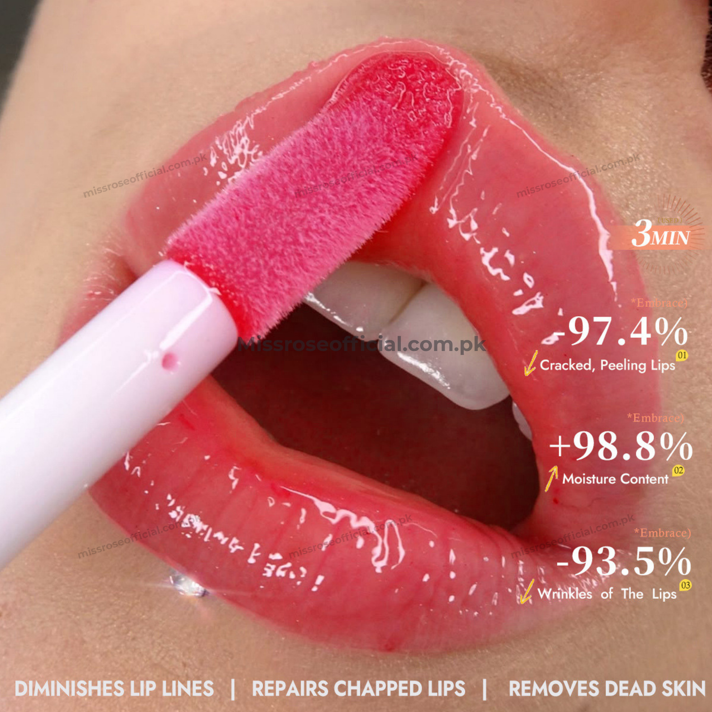 MISS RÔSE® Gloss Embrace Moisturizing Lip Comfort Essential Serum