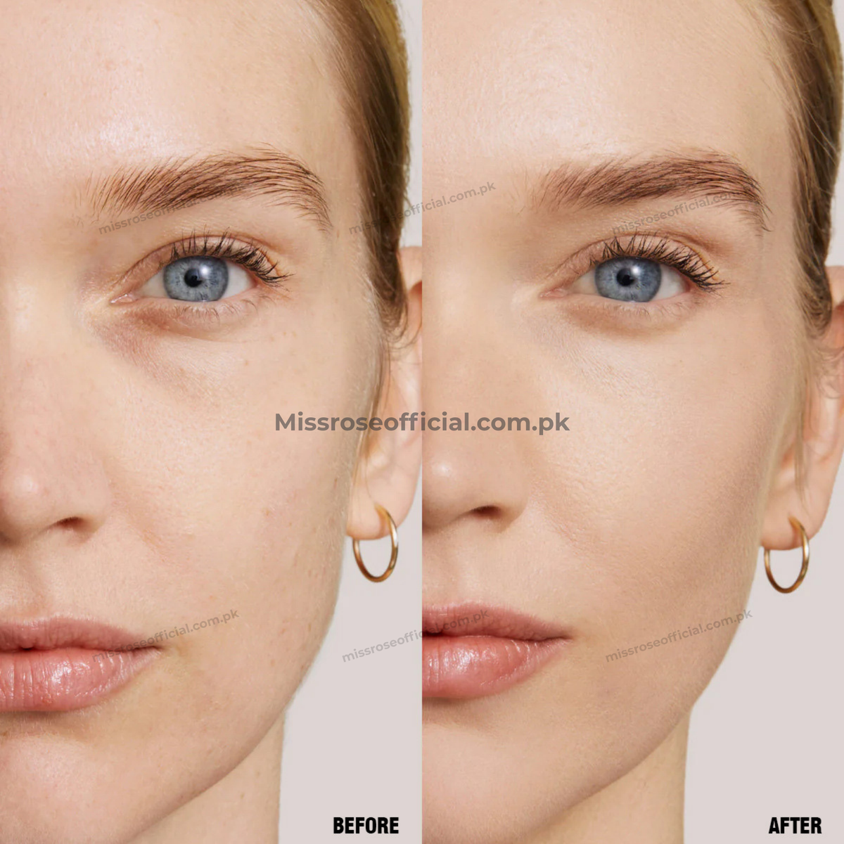 Miss Rose Blemish-Vanishing Concealer Stick
