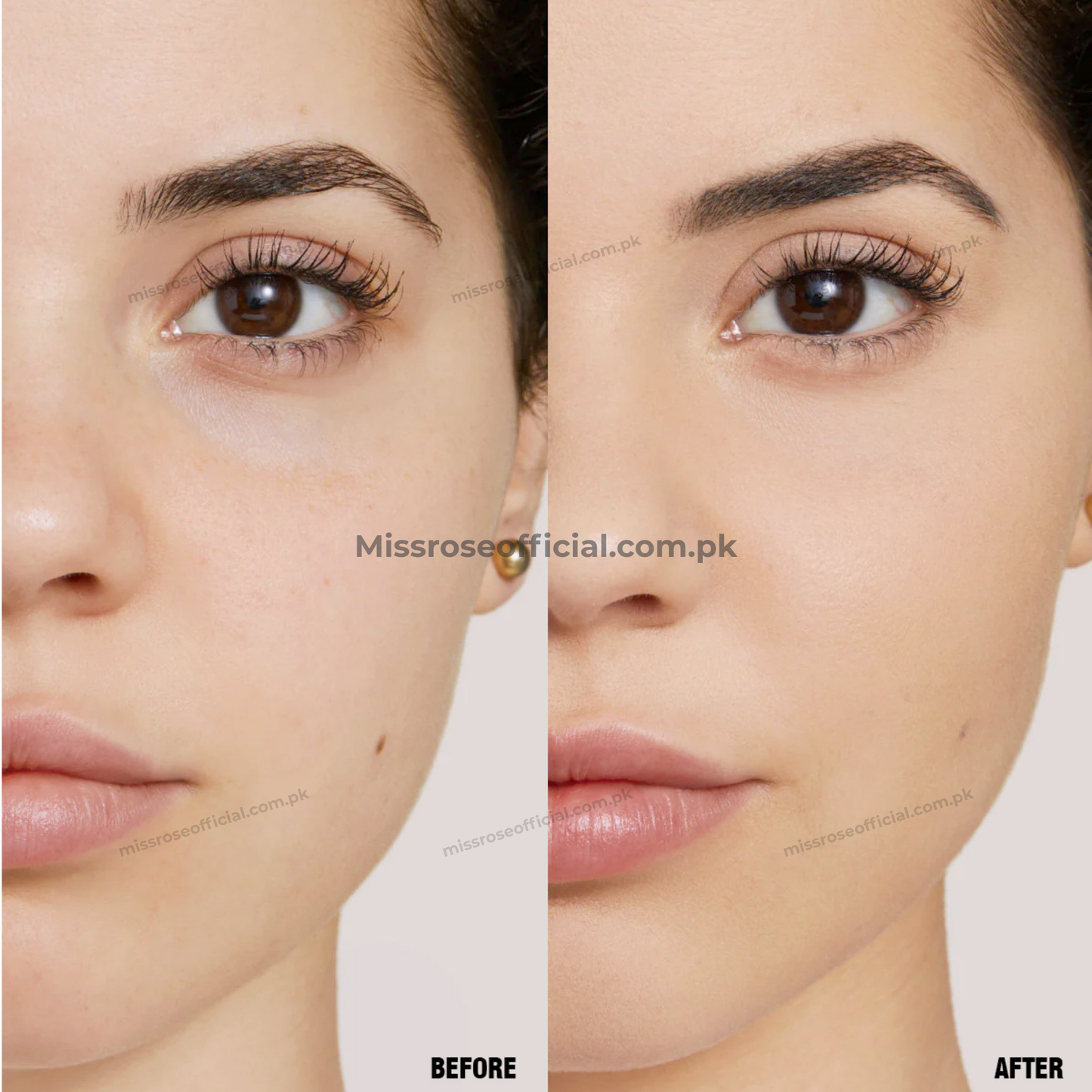 Miss Rose Blemish-Vanishing Concealer Stick