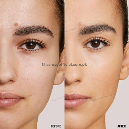 Miss Rose Blemish-Vanishing Concealer Stick