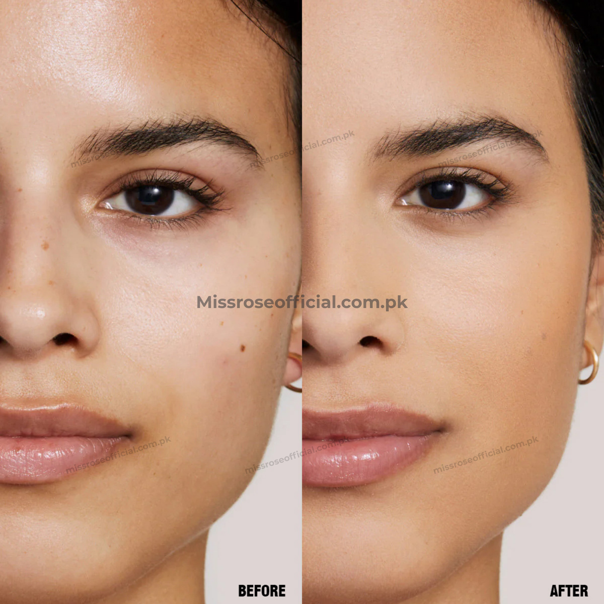 Miss Rose Blemish-Vanishing Concealer Stick