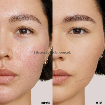 Miss Rose Blemish-Vanishing Concealer Stick
